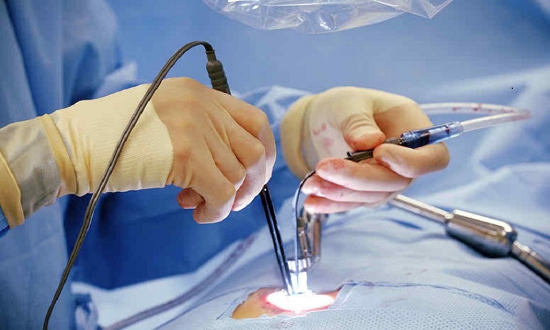 جراحی اندوسکوپی ستون فقرات